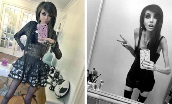 Piden cerrar canal de Youtuber por extrema delgadez
