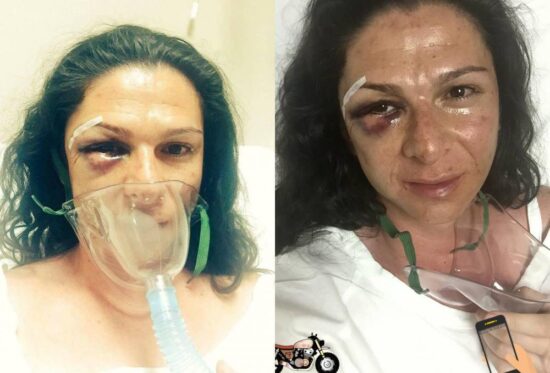 Agreden a Ana Gabriela Guevara