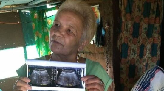 Mujer de 70 no está embarazada, tiene un tumor