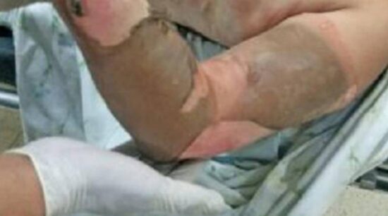 Llega ebrio y quema viva a su esposa