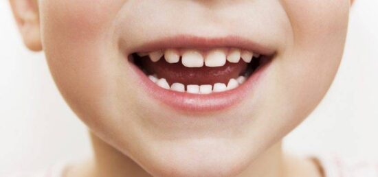 Caries afecta a más de 600 millones de niños