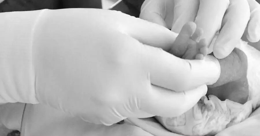 Mueren por tosferina 45 bebés en México